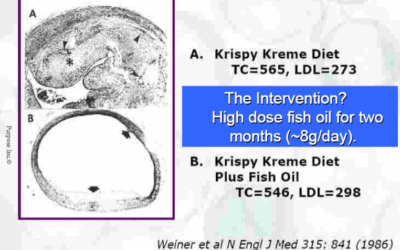 Is een hoog cholesterol echt zo erg? Of is het iets anders?