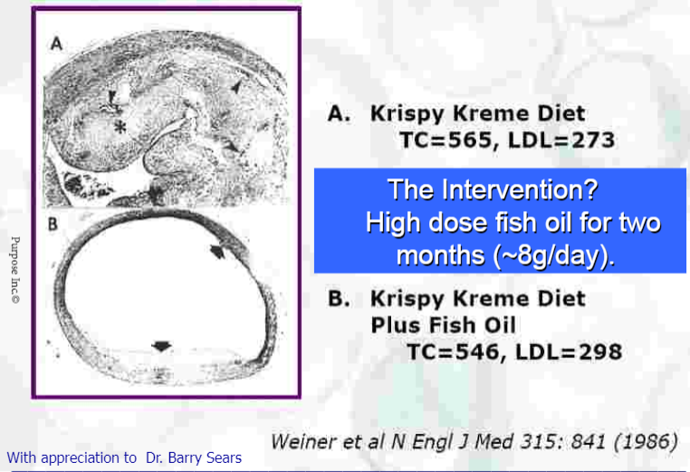 visolie op plaques Cholesterol mythe